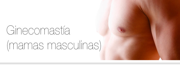 ginecomastia