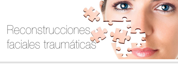 reconstruccion facial